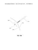 METHODS, DEVICES AND SYSTEMS FOR APPROXIMATION AND FASTENING OF SOFT     TISSUE diagram and image