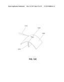 METHODS, DEVICES AND SYSTEMS FOR APPROXIMATION AND FASTENING OF SOFT     TISSUE diagram and image