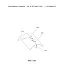 METHODS, DEVICES AND SYSTEMS FOR APPROXIMATION AND FASTENING OF SOFT     TISSUE diagram and image