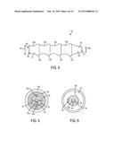 Methods and Devices for Passing Sutures Around Anatomical Structures diagram and image