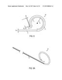 Methods and Devices for Passing Sutures Around Anatomical Structures diagram and image