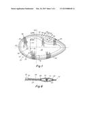 IMPLANTABLE PROSTHESIS FOR SOFT TISSUE REPAIR diagram and image