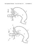 TISSUE FIXATION DEVICES AND ASSEMBLIES FOR DEPLOYING THE SAME diagram and image