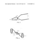 COMPRESSIVE SYSTEM FOR REDUCING EDGE BLEEDING IN CLASSICAL HYSTEROTOMY IN     CASES OF PLACENTA PRAEVIA diagram and image