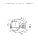 BALLOON CATHETER diagram and image