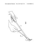 TISSUE TENSIONING DEVICES AND RELATED METHODS diagram and image