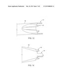 SURGICAL IMPLANT DEVICE AND SURGICAL IMPLANT INSERTION ASSEMBLY FOR THE     TRANSLATION AND FUSION OF A FACET JOINT OF THE SPINE diagram and image