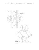 SPINAL IMPLANT DEVICE WITH FUSION CAGE AND FIXATION PLATES AND METHOD OF     IMPLANTING diagram and image