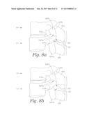 SPINAL IMPLANT DEVICE WITH FUSION CAGE AND FIXATION PLATES AND METHOD OF     IMPLANTING diagram and image