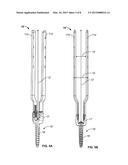 LUMBAR-SACRAL SCREW INSERTION AND MANIPULATION diagram and image