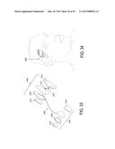 WEARABLE TRANSDERMAL ELECTRICAL STIMULATION DEVICES AND METHODS OF USING     THEM diagram and image