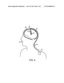 NEUROSTIMULATION SYSTEM FOR SELECTIVELY ESTIMATING VOLUME OF ACTIVATION     AND PROVIDING THERAPY diagram and image