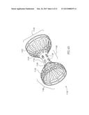 METHODS FOR TREATING ABNORMAL GROWTHS IN THE BODY USING A FLOW REDUCING     IMPLANT diagram and image