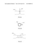 METHODS FOR TREATING ABNORMAL GROWTHS IN THE BODY USING A FLOW REDUCING     IMPLANT diagram and image