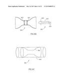 METHODS FOR TREATING ABNORMAL GROWTHS IN THE BODY USING A FLOW REDUCING     IMPLANT diagram and image