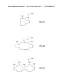 METHODS FOR TREATING ABNORMAL GROWTHS IN THE BODY USING A FLOW REDUCING     IMPLANT diagram and image