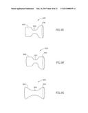 METHODS FOR TREATING ABNORMAL GROWTHS IN THE BODY USING A FLOW REDUCING     IMPLANT diagram and image