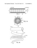 CLIP SHEATH FOR A POLYMER SCAFFOLD diagram and image