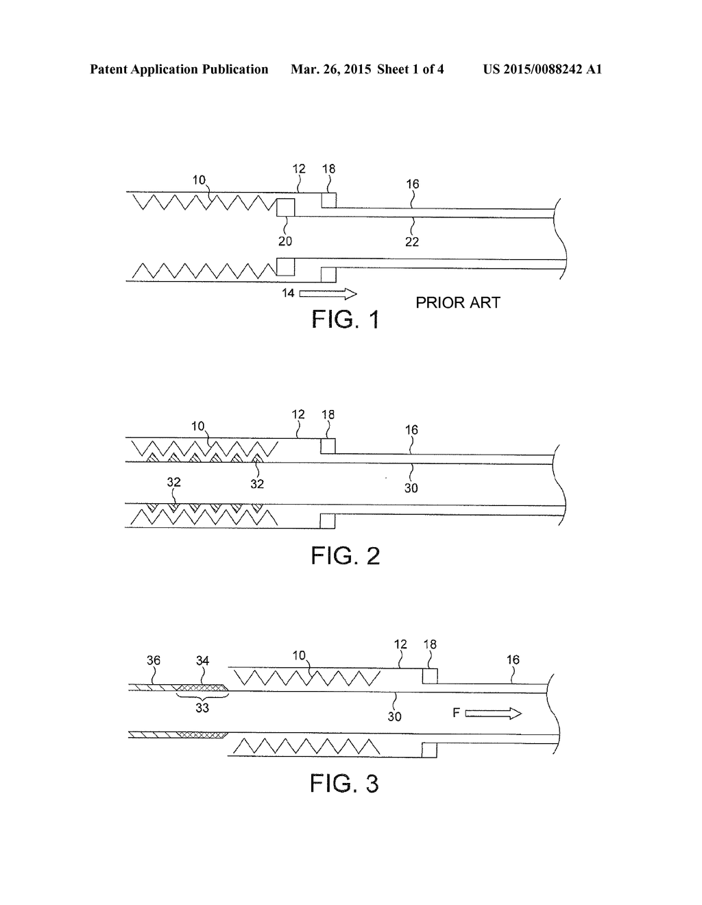 Transluminal Delivery System - diagram, schematic, and image 02