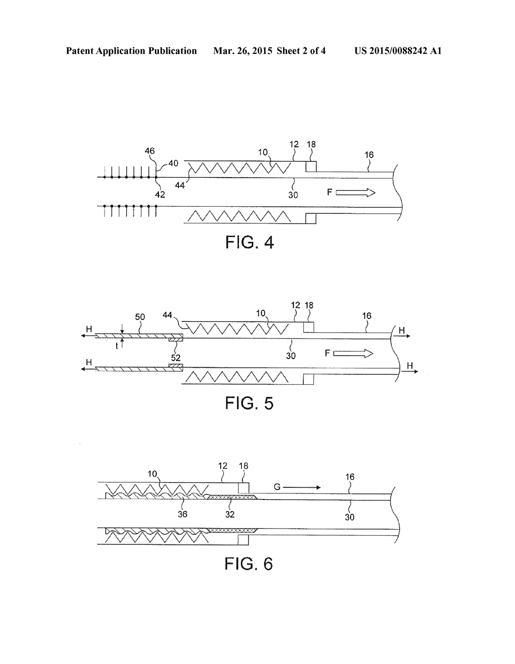 Transluminal Delivery System - diagram, schematic, and image 03