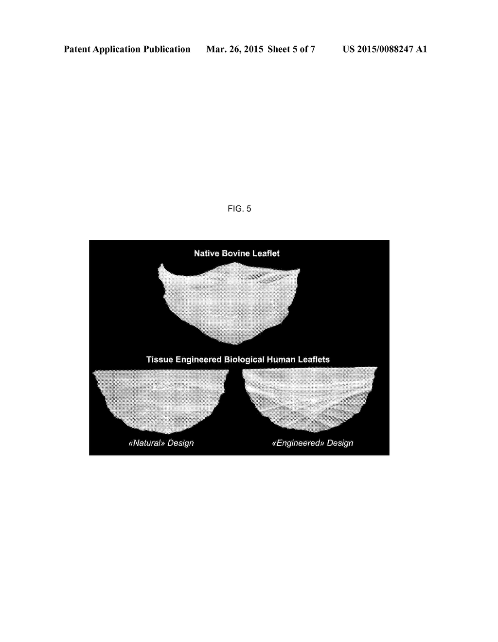 TISSUE-ENGINEERED HEART VALVE FOR TRANSCATHETER REPAIR - diagram, schematic, and image 06