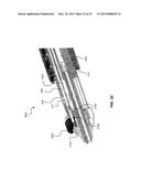 Heart Valve Delivery Catheter With Safety Button diagram and image