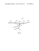 IMPLANTATION ASSEMBLY FOR A PROSTHETIC LIGAMENT diagram and image