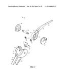 ELBOW PROSTHESIS diagram and image