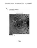 Systems and Methods for Diagnosing Inherited Retinal Diseases diagram and image