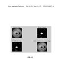 Systems and Methods for Diagnosing Inherited Retinal Diseases diagram and image