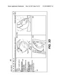 SYSTEMS AND METHODS FOR VALIDATING AND CORRECTING AUTOMATED MEDICAL IMAGE     ANNOTATIONS diagram and image