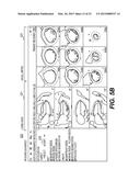 SYSTEMS AND METHODS FOR VALIDATING AND CORRECTING AUTOMATED MEDICAL IMAGE     ANNOTATIONS diagram and image