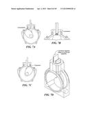 Isochoric Heat Addition Engines and Methods diagram and image