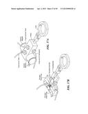 Isochoric Heat Addition Engines and Methods diagram and image