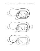 BLISTER TRACK INHALER DEVICE HAVING A SEPARATE END PATH AND METHODS OF USE     THEREOF diagram and image