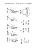 BREATHING MASK AND A SEALING LIP DEVICE FOR A BREATHING MASK diagram and image