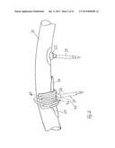 TIRE ASSEMBLY FOR A BICYCLE RIM diagram and image