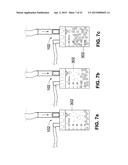 COLLECTION AND FILTRATION VIA SUCTION OF BIOLOGICAL MATERIAL DURING     SURGICAL PROCEDURE diagram and image