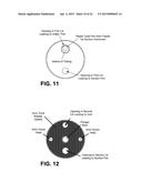 COLLECTION AND FILTRATION VIA SUCTION OF BIOLOGICAL MATERIAL DURING     SURGICAL PROCEDURE diagram and image