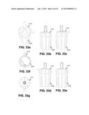 COLLECTION AND FILTRATION VIA SUCTION OF BIOLOGICAL MATERIAL DURING     SURGICAL PROCEDURE diagram and image