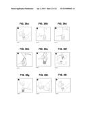 COLLECTION AND FILTRATION VIA SUCTION OF BIOLOGICAL MATERIAL DURING     SURGICAL PROCEDURE diagram and image