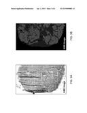 TUNABLE LASER-BASED INFRARED IMAGING SYSTEM AND METHOD OF USE THEREOF diagram and image