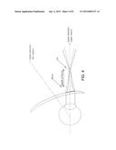 Progressive Addition Lens for a Wearer diagram and image