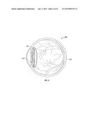 SYSTEMS AND METHODS FOR IMPLANTING AND EXAMINING INTRAOCULAR LENS diagram and image