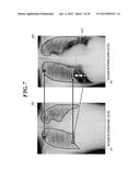 THORACIC DIAGNOSIS ASSISTANCE SYSTEM AND COMPUTER READABLE STORAGE MEDIUM diagram and image