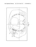 SYSTEM AND METHOD OF APPLYING AN ARBITRARY ANGLE TO REFORMAT MEDICAL     IMAGES diagram and image