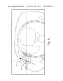 SYSTEM AND METHOD OF APPLYING AN ARBITRARY ANGLE TO REFORMAT MEDICAL     IMAGES diagram and image