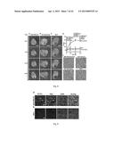 CELL-TARGETED MAGNETIC NANO-MATERIAL AND BIOMEDICAL USES THEREOF diagram and image