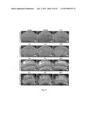 CELL-TARGETED MAGNETIC NANO-MATERIAL AND BIOMEDICAL USES THEREOF diagram and image