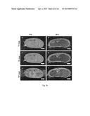 CELL-TARGETED MAGNETIC NANO-MATERIAL AND BIOMEDICAL USES THEREOF diagram and image